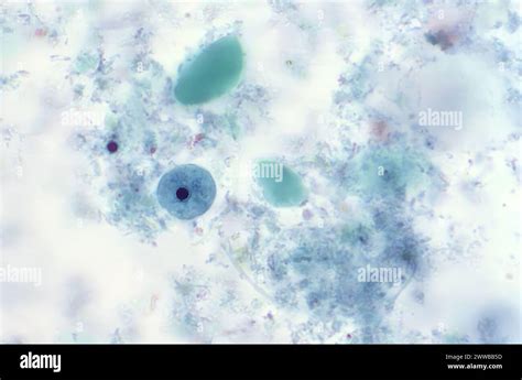  Iodamoeba! An Amoeboid That Thrives In Unexpected Environments