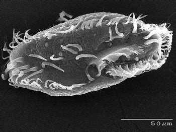  Mesodinium  -  An Enigma Wrapped in Cilia: Can This Tiny Protist Really Photosynthesize and Eat Its Prey Simultaneously?