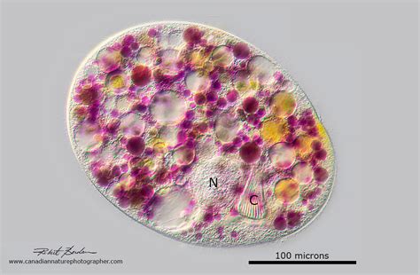  Nassula: A Tiny Pond Dweller with a Remarkable Appetite for Bacteria!