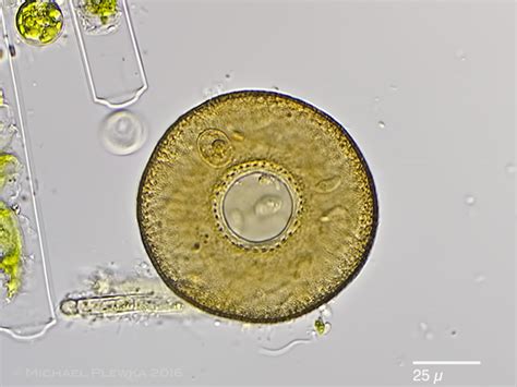  Rhizopods: หนอนพันธุ์นี้มีลวดลายสุดปริศนา!